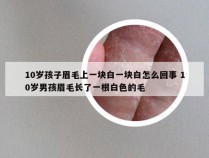 10岁孩子眉毛上一块白一块白怎么回事 10岁男孩眉毛长了一根白色的毛