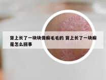 背上长了一块块像癣毛毛的 背上长了一块癣是怎么回事