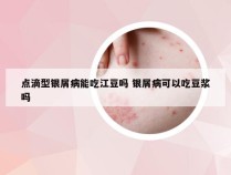 点滴型银屑病能吃江豆吗 银屑病可以吃豆浆吗