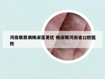 河南银屑病杨淑莲更优 杨淑银河南省口腔医院