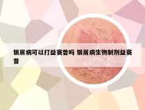 银屑病可以打益赛普吗 银屑病生物制剂益赛普