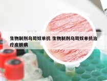 生物制剂乌司奴单抗 生物制剂乌司奴单抗治疗皮肤病