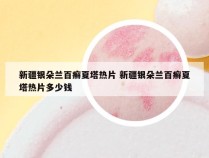 新疆银朵兰百癣夏塔热片 新疆银朵兰百癣夏塔热片多少钱