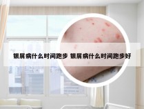 银屑病什么时间跑步 银屑病什么时间跑步好