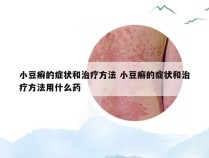 小豆癣的症状和治疗方法 小豆癣的症状和治疗方法用什么药