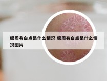 眼周有白点是什么情况 眼周有白点是什么情况图片