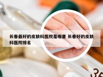 长春最好的皮肤科医院是哪里 长春好的皮肤科医院排名