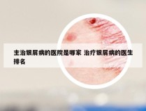 主治银屑病的医院是哪家 治疗银屑病的医生排名