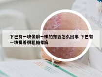 下巴有一块像癣一样的东西怎么回事 下巴有一块摸着很粗糙像癣