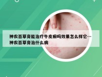 神农百草膏能治疗牛皮癣吗效果怎么样它… 神农百草膏治什么病