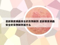 目前银屑病最安全的生物制剂 目前银屑病最安全的生物制剂是什么