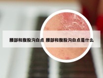 腰部和腹股沟白点 腰部和腹股沟白点是什么