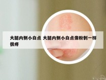 大腿内侧小白点 大腿内侧小白点像粉刺一样很疼