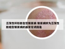 泛发性环形脓包型银屑病 银屑病转为泛发性脓疱型银屑病的最常见诱因是