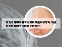 乌鲁木齐哪家有专治银屑病医院哪家好 新疆乌鲁木齐哪个医院看皮肤病好