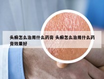 头癣怎么治用什么药膏 头癣怎么治用什么药膏效果好