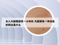 女人大腿根部有一小块白 大腿根有一块白色的斑这是什么