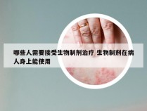 哪些人需要接受生物制剂治疗 生物制剂在病人身上能使用