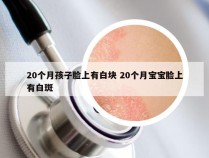 20个月孩子脸上有白块 20个月宝宝脸上有白斑