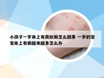 小孩子一岁身上有类似癣怎么回事 一岁的宝宝身上有癣越来越多怎么办