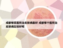 成都哪家医院治皮肤病最好 成都哪个医院治皮肤病比较好呢