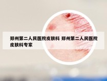 郑州第二人民医院皮肤科 郑州第二人民医院皮肤科专家