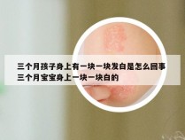 三个月孩子身上有一块一块发白是怎么回事 三个月宝宝身上一块一块白的