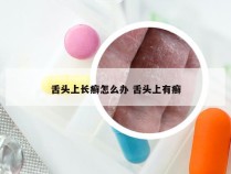 舌头上长癣怎么办 舌头上有癣