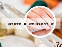 孩子脸发白一块一块的 孩子脸白了一块