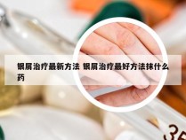 银屑治疗最新方法 银屑治疗最好方法抹什么药