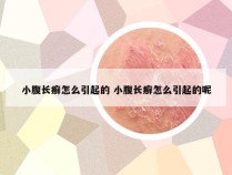 小腹长癣怎么引起的 小腹长癣怎么引起的呢