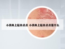 小孩身上起白点点 小孩身上起白点点是什么