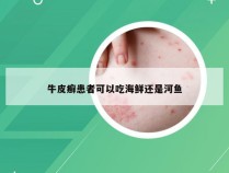 牛皮癣患者可以吃海鲜还是河鱼