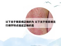 以下关于银屑病正确的为 以下关于银屑病流行病学特点描述正确的是