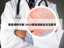 银屑病聊天群 2019银屑病微信交流群号