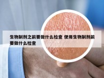 生物制剂之前要做什么检查 使用生物制剂前要做什么检查