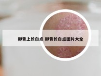 脚背上长白点 脚背长白点图片大全