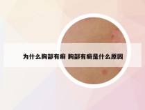 为什么胸部有癣 胸部有癣是什么原因