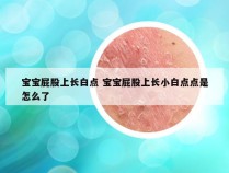 宝宝屁股上长白点 宝宝屁股上长小白点点是怎么了