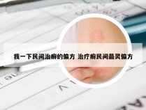 我一下民间治癣的偏方 治疗癣民间最灵偏方