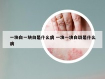 一块白一块白是什么病 一块一块白斑是什么病