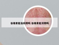 谷维素能治白斑吗 谷维素能淡斑吗