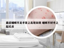 最近睡眠不足手背上出现白斑 睡眠不好手上起红点