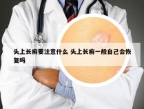 头上长癣要注意什么 头上长癣一般自己会恢复吗