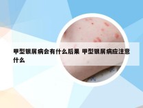 甲型银屑病会有什么后果 甲型银屑病应注意什么