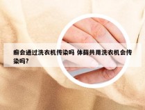 癣会通过洗衣机传染吗 体藓共用洗衣机会传染吗?