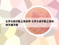 七岁小孩子脸上有白块 七岁小孩子脸上有白块不痛不痒