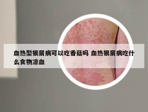 血热型银屑病可以吃香菇吗 血热银屑病吃什么食物凉血