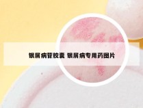 银屑病苷胶囊 银屑病专用药图片