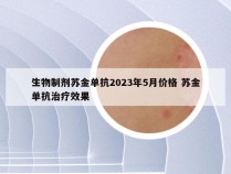 生物制剂苏金单抗2023年5月价格 苏金单抗治疗效果